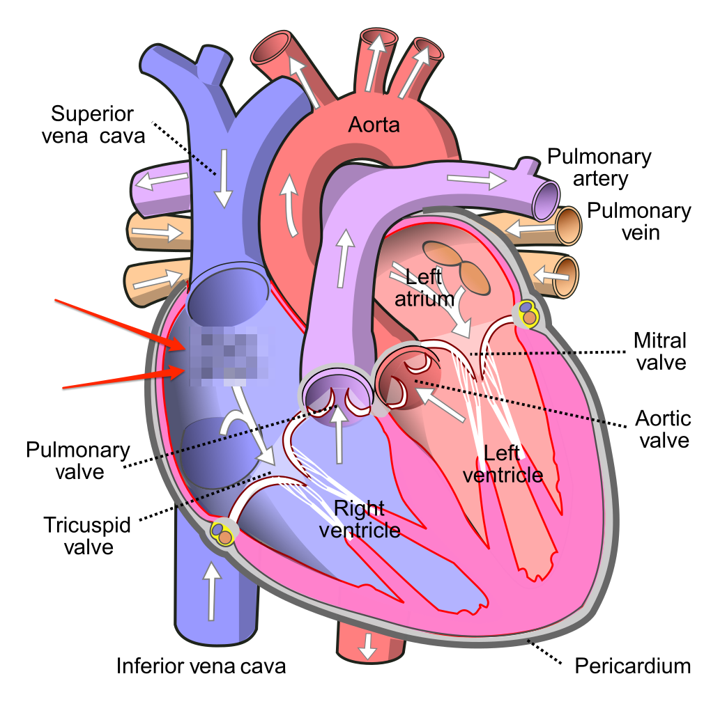 Heart Diagram missing right atrium